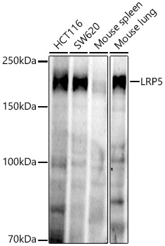 Western blot analysis of various lysates, using LRP5 Rabbit mAb at 1:1000 dilution.|Secondary antibody: HRP-conjugated Goat anti-Rabbit IgG (H+L) at 1:10000 dilution.|Lysates/proteins: 25μg per lane.|Blocking buffer: 3% nonfat dry milk in TBST.|Detection: ECL Enhanced Kit.|Exposure time: 180s.