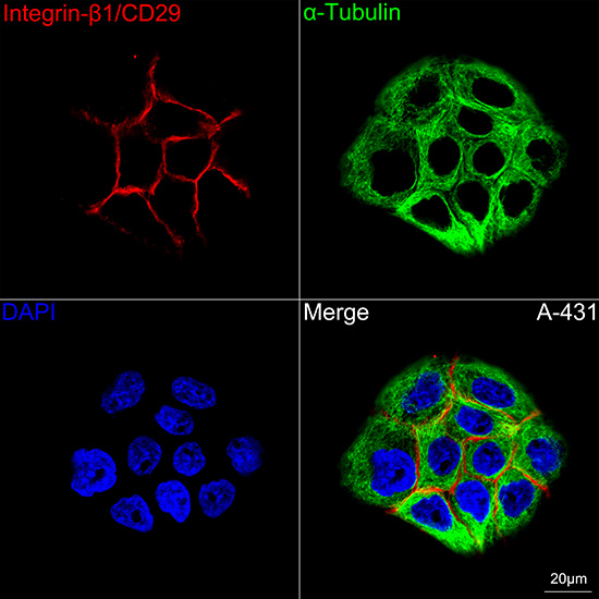 Confocal imaging of A-431 cells using Integrin-β1/CD29 Rabbit mAb followed by a further incubation with Cy3 Goat Anti-Rabbit IgG (H+L) (Red). The cells were counterstained with α-Tubulin Mouse mAb followed by incubation with PSFlo 488-conjugated Goat Anti-Mouse IgG (H+L) Ab (Green). DAPI was used for nuclear staining (Blue). Objective: 100x.
