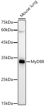 Western blot analysis of lysates from Mouse lung, using MyD88 Rabbit mAb at1:2000 dilution.|Secondary antibody: HRP-conjugated Goat anti-Rabbit IgG (H+L) at1:10000 dilution.|Lysates/proteins: 25μg per lane.|Blocking buffer: 3% nonfat dry milk in TBST.|Detection: ECL Basic Kit.|Exposure time: 180s.