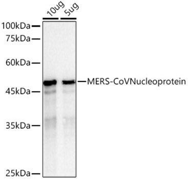 Western blot analysis of various lysates using MERS-CoV Nucleoprotein Rabbit mAb at 1:10000 dilution.|Secondary antibody: HRP-conjugated Goat anti-Rabbit IgG (H+L) at 1:10000 dilution.|Lysates/proteins: 25μg per lane.|Blocking buffer: 3% nonfat dry milk in TBST.|Detection: ECL Basic Kit.|Exposure time: 1s.