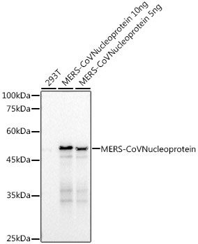 Western blot analysis of various lysates, using MERS-CoV Nucleoprotein Rabbit mAb at  1:3000 dilution.|Secondary antibody: HRP-conjugated Goat anti-Rabbit IgG (H+L) at 1:10000 dilution.|Lysates/proteins: 25μg per lane.|Blocking buffer: 3% nonfat dry milk in TBST.|Detection: ECL Basic Kit.|Exposure time: 3s.