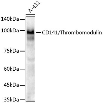 Western blot analysis of lysates from A-431 cells, using CD141/Thrombomodulin Rabbit mAb at1:2000 dilution.|Secondary antibody: HRP-conjugated Goat anti-Rabbit IgG (H+L) at 1:10000 dilution.|Lysates/proteins: 25μg per lane.|Blocking buffer: 3% nonfat dry milk in TBST.|Detection: ECL Enhanced Kit.|Exposure time: 90s.