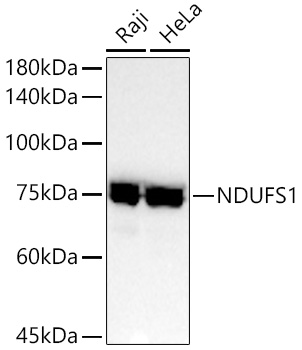 Western blot analysis of various lysates using NDUFS1 Rabbit mAb at 1:2000 dilution.|Secondary antibody: HRP-conjugated Goat anti-Rabbit IgG (H+L) at 1:10000 dilution.|Lysates/proteins: 25μg per lane.|Blocking buffer: 3% nonfat dry milk in TBST.|Detection: ECL Basic Kit.|Exposure time: 10s.