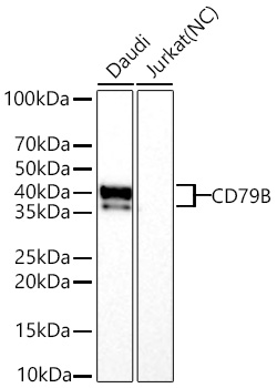 Western blot analysis of various lysates using CD79B Rabbit mAb at 1:50000 dilution incubated overnight at 4℃.|Secondary antibody: HRP-conjugated Goat anti-Rabbit IgG (H+L) at 1:10000 dilution.|Lysates/proteins: 25 μg per lane.|Blocking buffer: 3% nonfat dry milk in TBST.|Detection: ECL Basic Kit.|Negative control (NC): Jurkat|Exposure time: 60s.