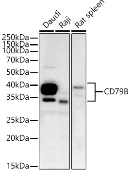 Western blot analysis of various lysates, using CD79B Rabbit mAb at 1:3600 dilution.|Secondary antibody: HRP-conjugated Goat anti-Rabbit IgG (H+L) at 1:10000 dilution.|Lysates/proteins: 25μg per lane.|Blocking buffer: 3% nonfat dry milk in TBST.|Detection: ECL Basic Kit.|Exposure time: 60s.