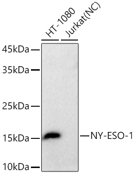 Western blot analysis of various lysates using NY-ESO-1 Rabbit mAb at 1:24000 dilution incubated overnight at 4℃.|Secondary antibody: HRP-conjugated Goat anti-Rabbit IgG (H+L) at 1:10000 dilution.|Lysates/proteins: 25 μg per lane.|Blocking buffer: 3% nonfat dry milk in TBST.|Detection: ECL Basic Kit.|Negative control (NC): Jurkat|Exposure time: 10s.