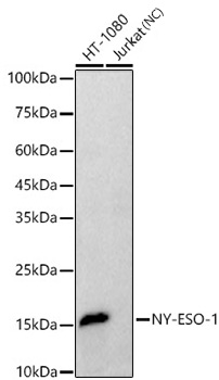 Western blot analysis of various lysates using NY-ESO-1 Rabbit mAb at  1:20000 dilution.|Secondary antibody: HRP-conjugated Goat anti-Rabbit IgG (H+L) at 1:10000 dilution.|Lysates/proteins: 25μg per lane.|Blocking buffer: 3% nonfat dry milk in TBST.|Detection: ECL Basic Kit.|Negative control (NC):Jurkat.|Exposure time: 10s.