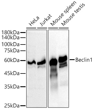 Western blot analysis of various lysates, using [KO Validated] Beclin 1 Rabbit mAb at 1:10000 dilution.|Secondary antibody: HRP-conjugated Goat anti-Rabbit IgG (H+L) at 1:10000 dilution.|Lysates/proteins: 25μg per lane.|Blocking buffer: 3% nonfat dry milk in TBST.|Detection: ECL Basic Kit.|Exposure time: 10s.