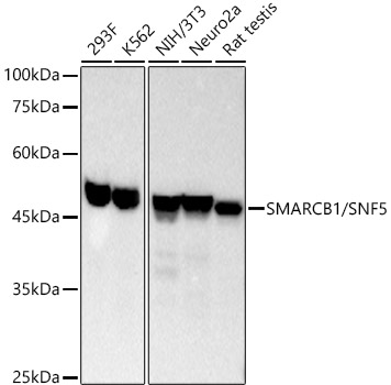 Western blot analysis of various lysates, using SMARCB1/SNF5 Rabbit mAb at 1:2000 dilution.|Secondary antibody: HRP-conjugated Goat anti-Rabbit IgG (H+L) at 1:2000 dilution.|Lysates/proteins: 25μg per lane.|Blocking buffer: 3% nonfat dry milk in TBST.|Detection: ECL Basic Kit.|Exposure time: 10s.