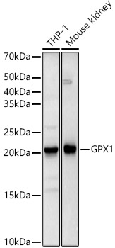 Western blot analysis of various lysates, using GPX1 Rabbit mAb at 1:2000 dilution.|Secondary antibody: HRP-conjugated Goat anti-Rabbit IgG (H+L) at 1:10000 dilution.|Lysates/proteins: 25μg per lane.|Blocking buffer: 3% nonfat dry milk in TBST.|Detection: ECL Basic Kit.|Exposure time: 3s.