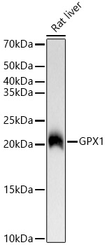 Western blot analysis of lysates from Rat liver, using GPX1 Rabbit mAb at  1:12000 dilution.|Secondary antibody: HRP-conjugated Goat anti-Rabbit IgG (H+L) at 1:10000 dilution.|Lysates/proteins: 25μg per lane.|Blocking buffer: 3% nonfat dry milk in TBST.|Detection: ECL Basic Kit.|Exposure time: 1s.