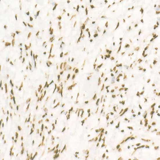 Immunohistochemistry analysis of paraffin-embedded Human heart using CDK12 Rabbit mAb at dilution of 1:500 (40x lens). High pressure antigen retrieval performed with 0.01M Citrate buffer (pH 6.0) prior to IHC staining.