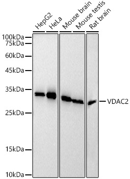 Western blot analysis of various lysates, using VDAC2 Rabbit mAb at 1:20000 dilution.|Secondary antibody: HRP-conjugated Goat anti-Rabbit IgG (H+L) at 1:10000 dilution.|Lysates/proteins: 25μg per lane.|Blocking buffer: 3% nonfat dry milk in TBST.|Detection: ECL Basic Kit.|Exposure time: 30s.