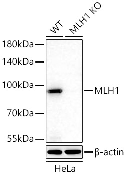 Western blot analysis of lysates from wild type (WT) and MLH1 knockout (KO) HeLa cells using [KO Validated] MLH1 Rabbit mAb at 1:8000 dilution incubated at room temperature for 1.5 hours.|Secondary antibody: HRP-conjugated Goat anti-Rabbit IgG (H+L) at 1:10000 dilution.|Lysates/proteins: 25 μg per lane.|Blocking buffer: 3% nonfat dry milk in TBST.|Detection: ECL Basic Kit.|Exposure time: 60 s.