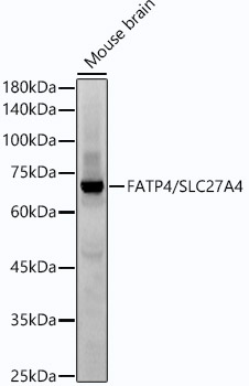 Western blot analysis of lysates from Mouse brain, using FATP4/SLC27A4 Rabbit mAb at1:2000 dilution.|Secondary antibody: HRP-conjugated Goat anti-Rabbit IgG (H+L) at 1:10000 dilution.|Lysates/proteins: 25μg per lane.|Blocking buffer: 3% nonfat dry milk in TBST.|Detection: ECL Basic Kit.|Exposure time: 60s.