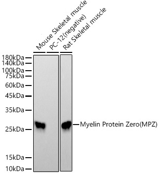 Western blot analysis of various lysates using Myelin Protein Zero (MPZ) Rabbit mAb at1:19000 dilution.|Secondary antibody: HRP-conjugated Goat anti-Rabbit IgG (H+L) at 1:10000 dilution.|Lysates/proteins: 25μg per lane.|Blocking buffer: 3% nonfat dry milk in TBST.|Detection: ECL Basic Kit.|Exposure time: 60s.