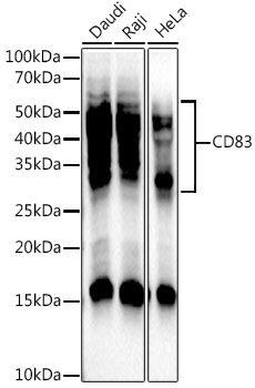 Western blot analysis of various lysates, using CD83 Rabbit mAb at 1:3000 dilution.|Secondary antibody: HRP-conjugated Goat anti-Rabbit IgG (H+L) at 1:10000 dilution.|Lysates/proteins: 25μg per lane.|Blocking buffer: 3% nonfat dry milk in TBST.|Detection: ECL Enhanced Kit.|Exposure time: 180s.