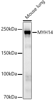Western blot analysis of lysates from mouse lung, using MYH14 Rabbit mAb at1:20000 dilution.|Secondary antibody: HRP-conjugated Goat anti-Rabbit IgG (H+L) at 1:10000 dilution.|Lysates/proteins: 25μg per lane.|Blocking buffer: 3% nonfat dry milk in TBST.|Detection: ECL Basic Kit.|Exposure time: 180s.