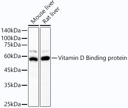 Western blot analysis of various lysates using Vitamin D Binding protein Rabbit mAb at 1:1000 dilution.|Secondary antibody: HRP-conjugated Goat anti-Rabbit IgG (H+L) at 1:10000 dilution.|Lysates/proteins: 25μg per lane.|Blocking buffer: 3% nonfat dry milk in TBST.|Detection: ECL Basic Kit.|Exposure time: 180s.