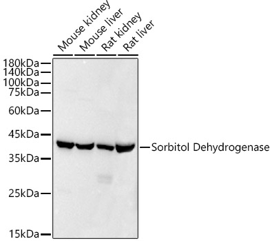 Western blot analysis of various lysates using Sorbitol Dehydrogenase Rabbit mAb at1:20000 dilution.|Secondary antibody: HRP-conjugated Goat anti-Rabbit IgG (H+L) at 1:10000 dilution.|Lysates/proteins: 25μg per lane.|Blocking buffer: 3% nonfat dry milk in TBST.|Detection: ECL Basic Kit.|Exposure time: 10s.