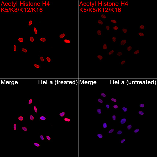 Confocal imaging of HeLa cells (treated with TSA) and HeLa cells (untreated) cells using Acetyl-Histone H4-K5/K8/K12/K16 Rabbit mAb followed by a further incubation with Cy3 Goat Anti-Rabbit IgG (H+L) (Red). DAPI was used for nuclear staining (Blue). Objective: 100x.