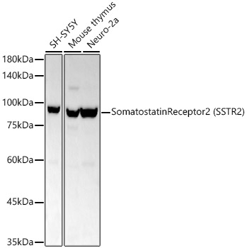 Western blot analysis of various lysates, using Somatostatin Receptor 2 (SSTR2) Rabbit mAb at 1:1000 dilution.|Secondary antibody: HRP-conjugated Goat anti-Rabbit IgG (H+L) at 1:10000 dilution.|Lysates/proteins: 25μg per lane.|Blocking buffer: 3% nonfat dry milk in TBST.|Detection: ECL Basic Kit.|Exposure time: 90s.