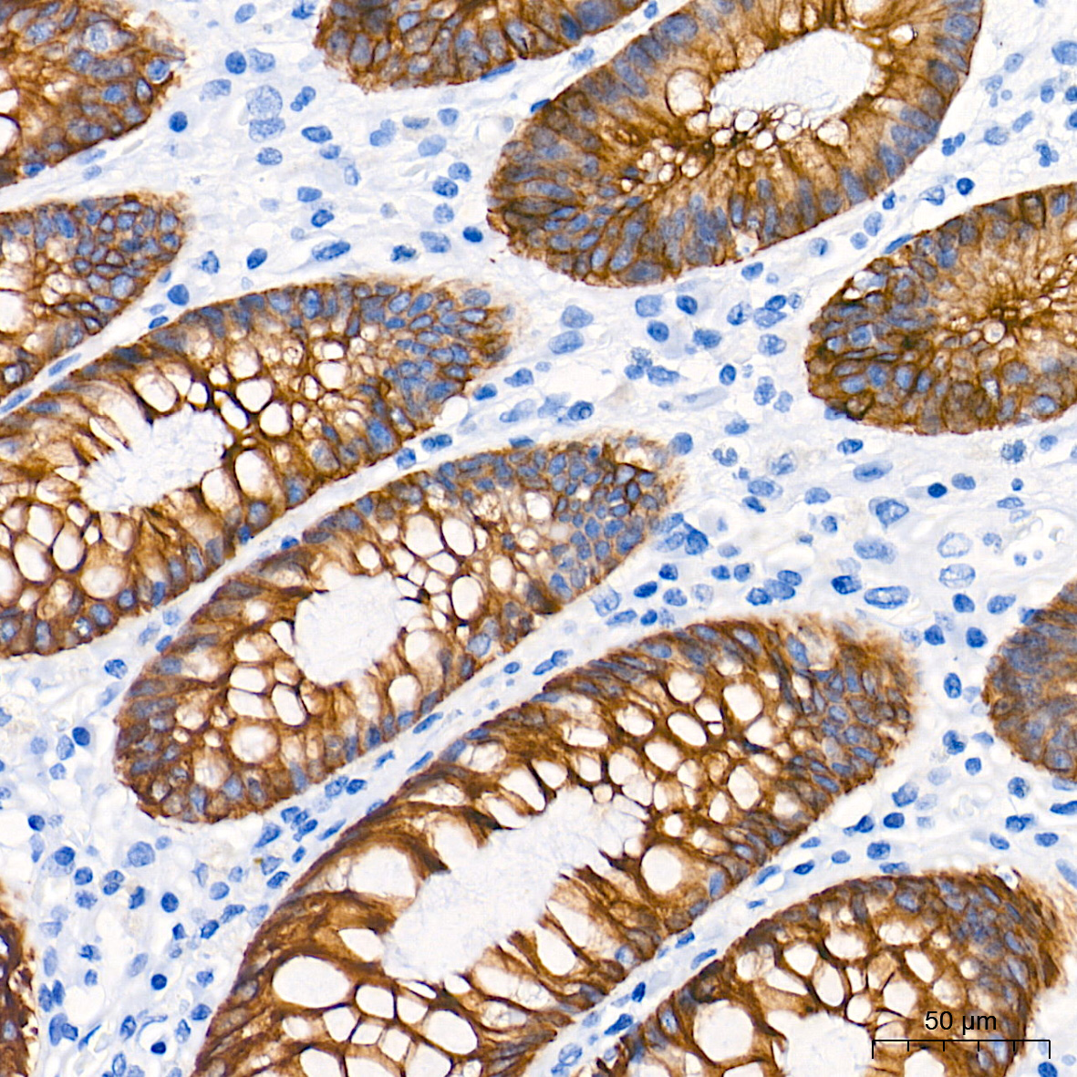 Immunohistochemistry analysis of paraffin-embedded Human colon tissue using Cytokeratin 19 (KRT19) Rabbit mAb at a dilution of 1:10000 (40x lens). High pressure antigen retrieval performed with 0.01M Tris-EDTA Buffer (pH 9.0) prior to IHC staining.