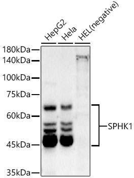 Western blot analysis of various lysates using SPHK1 Rabbit mAb at1:2000 dilution.|Secondary antibody: HRP-conjugated Goat anti-Rabbit IgG (H+L) at 1:10000 dilution.|Lysates/proteins: 25μg per lane.|Blocking buffer: 3% nonfat dry milk in TBST.|Detection: ECL Basic Kit.|Exposure time: 10s.