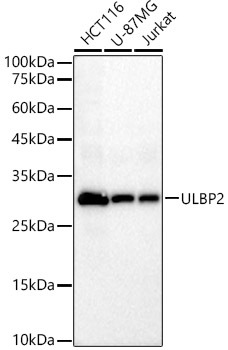 Western blot analysis of various lysates, using ULBP2 Rabbit mAb at 1:2000 dilution.|Secondary antibody: HRP-conjugated Goat anti-Rabbit IgG (H+L) at 1:10000 dilution.|Lysates/proteins: 25μg per lane.|Blocking buffer: 3% nonfat dry milk in TBST.|Detection: ECL Basic Kit.|Exposure time: 45s.