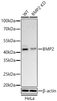 Western blot analysis of lysates from wild type (WT) and BMP2 knockdown (KD) HeLa cells using [KD Validated] BMP2 Rabbit mAb at 1:1000 dilution incubated overnight at 4℃.|Secondary antibody: HRP-conjugated Goat anti-Rabbit IgG (H+L) at 1:10000 dilution.|Lysates/proteins: 25 μg per lane.|Blocking buffer: 3% nonfat dry milk in TBST.|Detection: ECL Basic Kit.|Exposure time: 45s.
