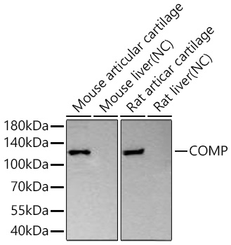 Western blot analysis of various lysates using COMP Rabbit mAb at 1:5000 dilution incubated overnight at 4℃.|Secondary antibody: HRP-conjugated Goat anti-Rabbit IgG (H+L) at 1:10000 dilution.|Lysates/proteins: 25 μg per lane.|Blocking buffer: 3% nonfat dry milk in TBST.|Detection: ECL Basic Kit.|Negative control (NC): Mouse liver, Rat liver.|Exposure time: 90 s.