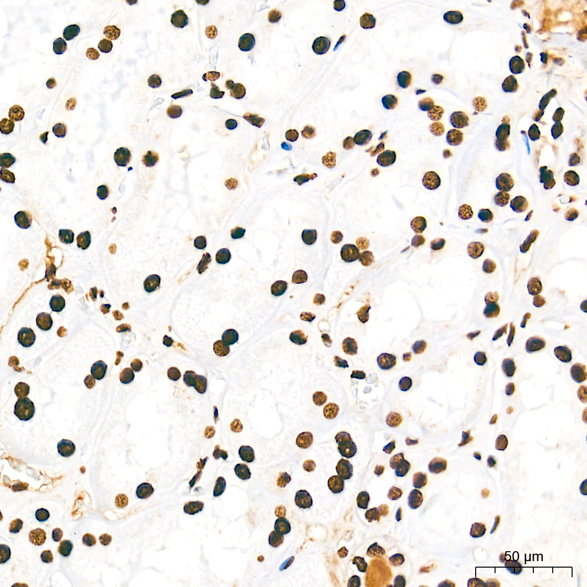 Immunohistochemistry analysis of paraffin-embedded Human kidney tissue using MonoMethyl-Histone H3-K9 Rabbit mAb at a dilution of 1:5000 (40x lens). High pressure antigen retrieval performed with 0.01M Tris-EDTA Buffer (pH 9.0) prior to IHC staining.