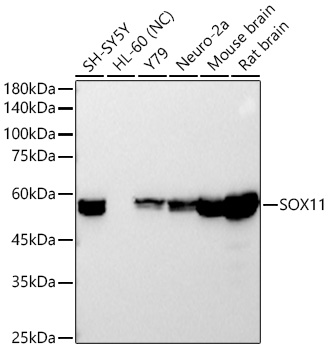 Western blot analysis of various lysates using SOX11 Rabbit mAb at1:20000 dilution.|Secondary antibody: HRP-conjugated Goat anti-Rabbit IgG (H+L) at 1:10000 dilution.|Lysates/proteins: 25μg per lane.|Blocking buffer: 3% nonfat dry milk in TBST.|Detection: ECL Basic Kit.|Exposure time: 10s.
