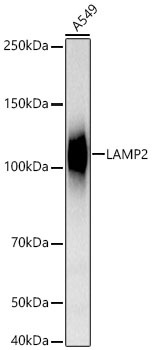 Western blot analysis of lysates from A549 cells using [KO Validated] LAMP2 Rabbit mAb at 1:20000 dilution.|Secondary antibody: HRP-conjugated Goat anti-Rabbit IgG (H+L) at 1:10000 dilution.|Lysates/proteins: 25 μg per lane.|Blocking buffer: 3% nonfat dry milk in TBST.|Detection: ECL Basic Kit.|Exposure time:10s.
