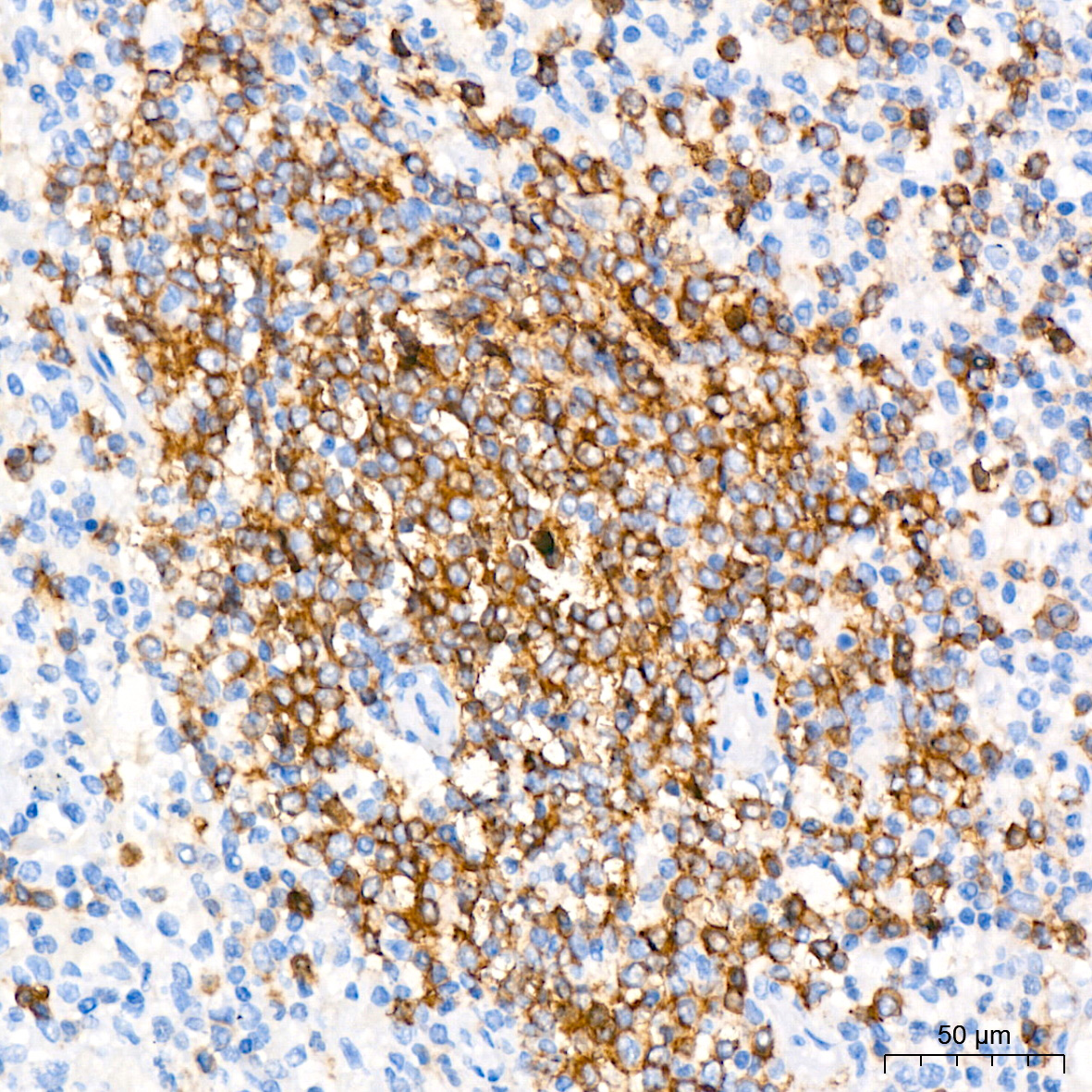 Immunohistochemistry analysis of paraffin-embedded Human tonsil tissue using CD45RA Rabbit mAb at a dilution of 1:200 (40x lens). High pressure antigen retrieval performed with 0.01M Tris-EDTA Buffer (pH 9.0) prior to IHC staining.