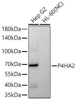 Western blot analysis of various lysates using P4HA2 Rabbit mAb at 1:5000 dilution incubated overnight at 4℃.|Secondary antibody: HRP-conjugated Goat anti-Rabbit IgG (H+L) at 1:10000 dilution.|Lysates/proteins: 25 μg per lane.|Blocking buffer: 3% nonfat dry milk in TBST.|Detection: ECL Basic Kit.|Negative control (NC): HL-60.|Exposure time: 90 s.