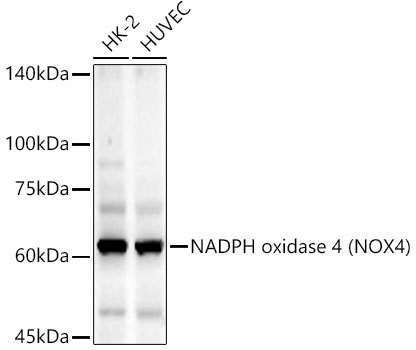 Western blot analysis of various lysates, using NADPH oxidase 4 (NOX4) Rabbit mAb at  1:1000 dilution.|Secondary antibody: HRP-conjugated Goat anti-Rabbit IgG (H+L) at 1:10000 dilution.|Lysates/proteins: 25μg per lane.|Blocking buffer: 3% nonfat dry milk in TBST.|Detection: ECL Basic Kit.|Exposure time: 90s.