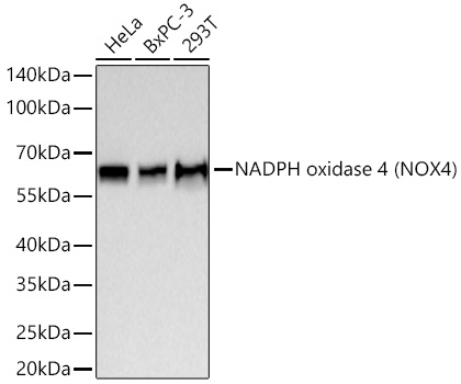 Western blot analysis of various lysates using NADPH oxidase 4 (NOX4) Rabbit mAb at 1:1000 dilution incubated overnight at 4℃.|Secondary antibody: HRP-conjugated Goat anti-Rabbit IgG (H+L) at 1:10000 dilution.|Lysates/proteins: 25 μg per lane.|Blocking buffer: 3% nonfat dry milk in TBST.|Detection: ECL Basic Kit.|Exposure time: 60s.
