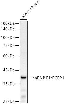 Western blot analysis of lysates from Mouse brain using hnRNP E1/PCBP1 Rabbit mAb at 1:2000 dilution.|Secondary antibody: HRP-conjugated Goat anti-Rabbit IgG (H+L) at 1:10000 dilution.|Lysates/proteins: 25μg  per lane.|Blocking buffer: 3% nonfat dry milk in TBST.|Detection: ECL Basic Kit.|Exposure time: 30s.