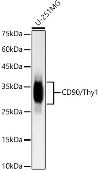 Western blot analysis of lysates from U-251 MG cells using [KD Validated] CD90/Thy1 Rabbit mAb at  1:20000 dilution.|Secondary antibody: HRP-conjugated Goat anti-Rabbit IgG (H+L) at 1:10000 dilution.|Lysates/proteins: 25μg per lane.|Blocking buffer: 3% nonfat dry milk in TBST.|Detection: ECL Basic Kit.|Exposure time: 180s.