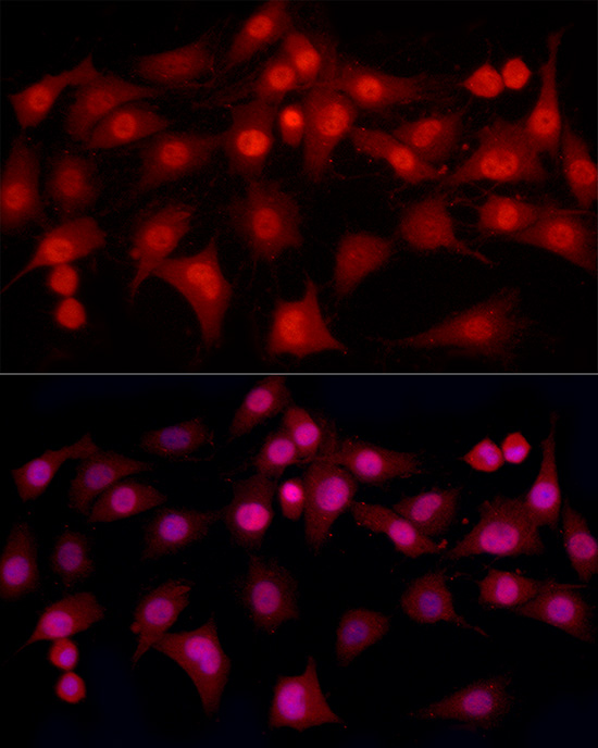 Immunofluorescence analysis of C6 cells using ESRα Rabbit mAb at dilution of 1:100(40x lens). Secondary antibody: Cy3-conjugated Goat anti-Rabbit IgG (H+L) at 1:500 dilution. Blue: DAPI for nuclear staining.