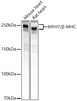 Western blot analysis of various lysates using MYH7/β-MHC Rabbit mAb at 1:2000 dilution incubated overnight at 4℃.|Secondary antibody: HRP-conjugated Goat anti-Rabbit IgG (H+L) at 1:10000 dilution.|Lysates/proteins: 25μg per lane.|Blocking buffer: 3% nonfat dry milk in TBST.|Detection: ECL Basic Kit.|Exposure time: 4s.
