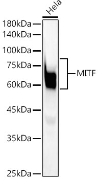 Western blot analysis of lysates from Hela cells, using MITF Rabbit mAb at1:20000 dilution.|Secondary antibody: HRP-conjugated Goat anti-Rabbit IgG (H+L) at 1:10000 dilution.|Lysates/proteins: 25μg per lane.|Blocking buffer: 3% nonfat dry milk in TBST.|Detection: ECL Basic Kit.|Exposure time: 30s.