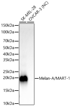 Western blot analysis of various lysates, using Melan-A/MART-1 Rabbit mAb at1:2000 dilution.|Secondary antibody: HRP-conjugated Goat anti-Rabbit IgG (H+L) at 1:10000 dilution.|Lysates/proteins: 25μg per lane.|Blocking buffer: 3% nonfat dry milk in TBST.|Detection: ECL Basic Kit.|Exposure time: 10s.
