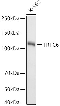 Western blot analysis of lysates from K-562 cells, using TRPC6 Rabbit mAb at  1:2000 dilution.|Secondary antibody: HRP-conjugated Goat anti-Rabbit IgG (H+L) at 1:10000 dilution.|Lysates/proteins: 25μg per lane.|Blocking buffer: 3% nonfat dry milk in TBST.|Detection: ECL Basic Kit.|Exposure time: 180s.