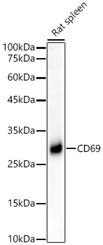 Western blot analysis of lysates from Rat spleen, using CD69 Rabbit mAb at1:4000 dilution.|Secondary antibody: HRP-conjugated Goat anti-Rabbit IgG (H+L) at 1:10000 dilution.|Lysates/proteins: 25μg per lane.|Blocking buffer: 3% nonfat dry milk in TBST.|Detection: ECL Basic Kit.|Exposure time: 90s.
