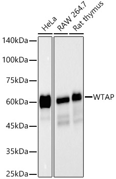Western blot analysis of various lysates, using WTAP Rabbit mAb at  1:40000 dilution.|Secondary antibody: HRP-conjugated Goat anti-Rabbit IgG (H+L) at 1:10000 dilution.|Lysates/proteins: 25μg per lane.|Blocking buffer: 3% nonfat dry milk in TBST.|Detection: ECL Basic Kit.|Exposure time: 30s.