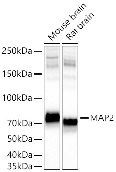 Western blot analysis of various lysates using MAP2 Rabbit mAb at 1:11000 dilution incubated overnight at 4℃.|Secondary antibody: HRP-conjugated Goat anti-Rabbit IgG (H+L) at 1:10000 dilution.|Lysates/proteins: 25 μg per lane.|Blocking buffer: 3% nonfat dry milk in TBST.|Detection: ECL Basic Kit.|Exposure time: 20s.