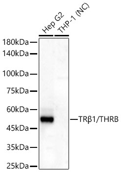 Western blot analysis of various lysates, using TRβ1/THRB Rabbit mAb at 1:2000 dilution.|Secondary antibody: HRP-conjugated Goat anti-Rabbit IgG (H+L) at 1:10000 dilution.|Lysates/proteins: 25μg per lane.|Blocking buffer: 3% nonfat dry milk in TBST.|Detection: ECL Basic Kit.|Exposure time: 180s.