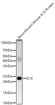 Western blot analysis of various lysates, using IL10 Rabbit mAb at1:2000 dilution.|Secondary antibody: HRP-conjugated Goat anti-Rabbit IgG (H+L) at 1:10000 dilution.|Lysates/proteins: 25μg per lane.|Blocking buffer: 3% nonfat dry milk in TBST.|Detection: ECL Enhanced Kit.|Exposure time: 180s.